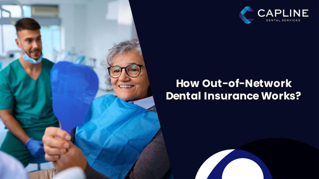 How Out-of-Network Dental Insurance Works?